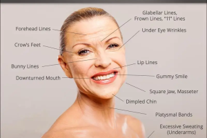 Understanding Botox: How it works, and what to expect