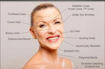 Understanding Botox: How it works, and what to expect