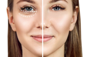 Say Goodbye to Puffy Eyes: Tips for Reducing Under-Eye Bags