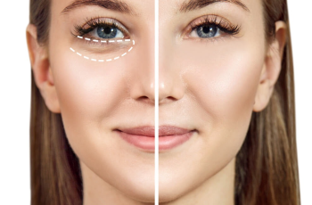 Say Goodbye to Puffy Eyes: Tips for Reducing Under-Eye Bags